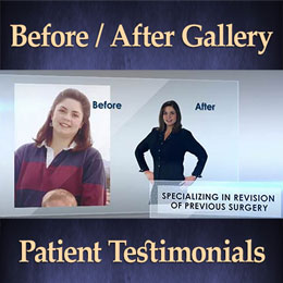 Before / After Patient Photo Gallery and Testimonials